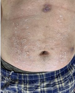 超细打磨的鞋跟大腿钻血洞，10和12厘米高跟跺肚子 YC-211012-3_绳艺资料库