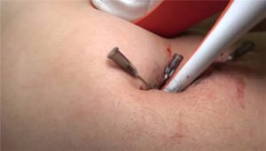 【冷柔】超残忍虐乳_绳艺资料库